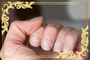 قارچ کاشت ناخن-عوارض هوا گرفتن کاشت ناخن
